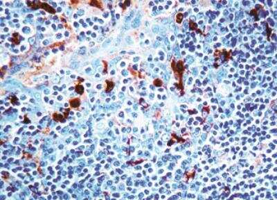 Immunohistochemistry-Paraffin: Serpin A3/alpha 1-Antichymotrypsin Antibody [NB120-9374]