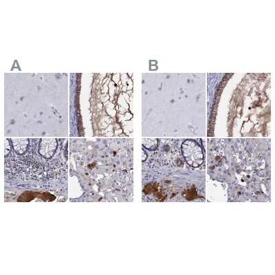 Immunohistochemistry-Paraffin: Serpin A3/alpha 1-Antichymotrypsin Antibody [NBP1-90295]
