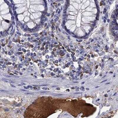 Immunohistochemistry-Paraffin: Serpin A3/alpha 1-Antichymotrypsin Antibody [NBP1-90295]