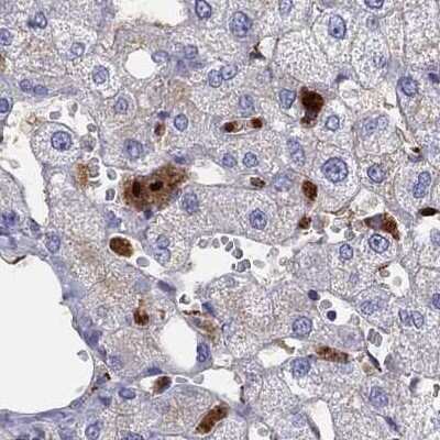 Immunohistochemistry-Paraffin: Serpin A3/alpha 1-Antichymotrypsin Antibody [NBP1-90295]