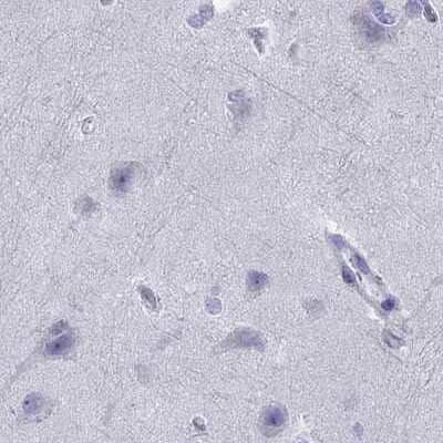 Immunohistochemistry-Paraffin: Serpin A3/alpha 1-Antichymotrypsin Antibody [NBP1-90295]