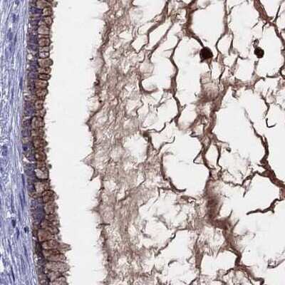 Immunohistochemistry-Paraffin: Serpin A3/alpha 1-Antichymotrypsin Antibody [NBP1-90295]