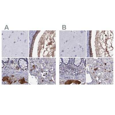 Immunohistochemistry-Paraffin: Serpin A3/alpha 1-Antichymotrypsin Antibody [NBP1-90296]