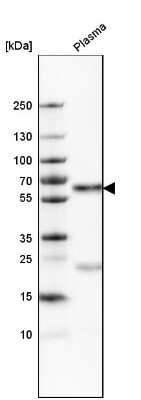 Western Blot: Serpin A3/alpha 1-Antichymotrypsin Antibody [NBP1-90295]