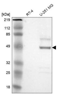 Western Blot: Serpin A3/alpha 1-Antichymotrypsin Antibody [NBP1-90296]