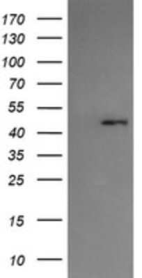 Western Blot: Serpin A5/Protein C Inhibitor Antibody (OTI1C4) [NBP2-45764]