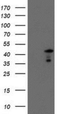 Western Blot: Serpin A5/Protein C Inhibitor Antibody (OTI2D10) [NBP2-01833]