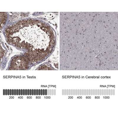 Immunocytochemistry/ Immunofluorescence: Serpin A5/Protein C Inhibitor Antibody [NBP3-17021]