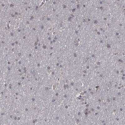 Immunohistochemistry-Paraffin: Serpin A5/Protein C Inhibitor Antibody [NBP3-17021]