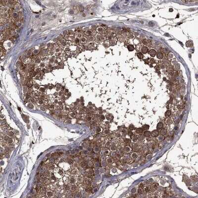 Immunohistochemistry-Paraffin: Serpin A5/Protein C Inhibitor Antibody [NBP3-17021]