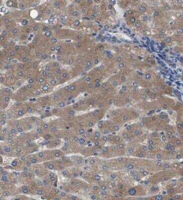 Immunohistochemistry-Paraffin: Serpin A6/Cortisol Binding Globulin Antibody [NBP1-88174]