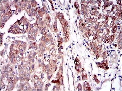 Immunohistochemistry: Serpin A7/TBG Antibody (5B11E9) - BSA Free [NBP2-37322]