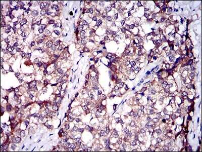 Immunohistochemistry: Serpin A7/TBG Antibody (5B11E9) - BSA Free [NBP2-37322]