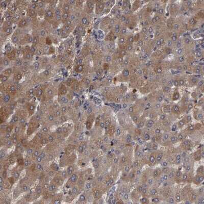 Immunohistochemistry-Paraffin: Serpin A7/TBG Antibody [NBP1-86963]
