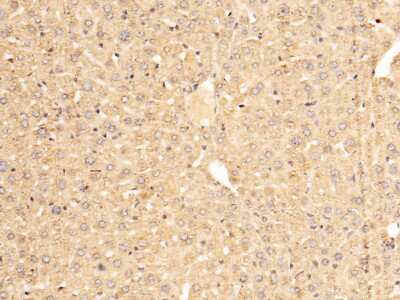 Immunohistochemistry-Paraffin: Serpin A7/TBG Antibody [NBP2-98256]