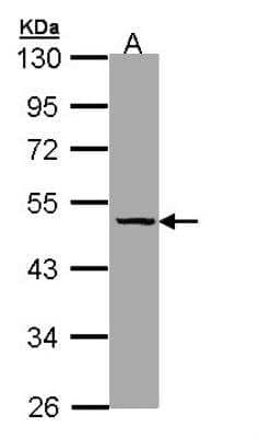 Western Blot: Serpin A7/TBG Antibody [NBP1-32963]