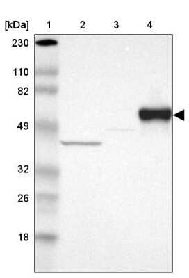 Western Blot: Serpin A7/TBG Antibody [NBP1-86963]