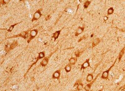 Immunohistochemistry-Paraffin: Serpin A8/Angiotensinogen Antibody (034) [NBP2-89737]