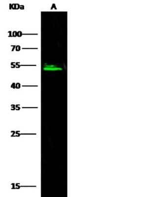 Western Blot: Serpin A8/Angiotensinogen Antibody (1) [NBP2-89736]