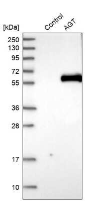 Western Blot: Serpin A8/Angiotensinogen Antibody [NBP1-87053]