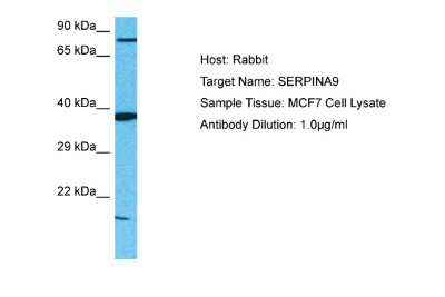 Western Blot: Serpin A9/Centerin Antibody [NBP2-86802]