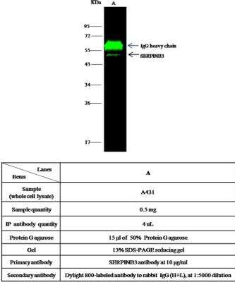 Immunoprecipitation: Serpin B3/SCCA1 Antibody (018) [NBP2-90195]