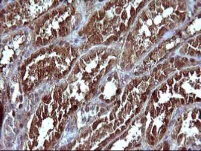 Immunohistochemistry: Serpin B3/SCCA1 Antibody (OTI1A12) [NBP2-45788]