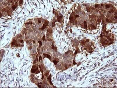 Immunohistochemistry: Serpin B3/SCCA1 Antibody (OTI1A12) [NBP2-45788]