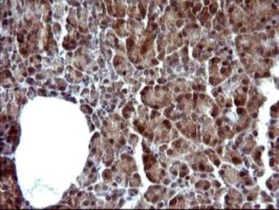 Immunohistochemistry: Serpin B3/SCCA1 Antibody (OTI1A12) [NBP2-45788]