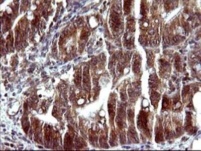 Immunohistochemistry: Serpin B3/SCCA1 Antibody (OTI1A12) [NBP2-45788]
