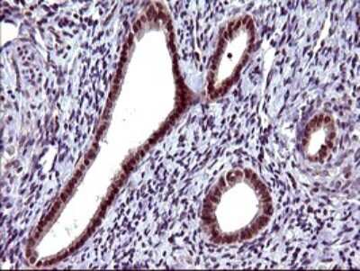 Immunohistochemistry: Serpin B3/SCCA1 Antibody (OTI1A12) [NBP2-45788]