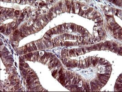 Immunohistochemistry: Serpin B3/SCCA1 Antibody (OTI1A12) [NBP2-45788]