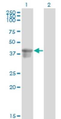 Western Blot: Serpin B3/SCCA1 Antibody (2F5) [H00006317-M01]