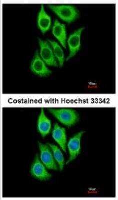 Immunocytochemistry/ Immunofluorescence: Serpin B3/SCCA1 Antibody [NBP2-20310]