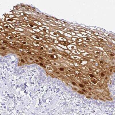 Immunohistochemistry: Serpin B3/SCCA1 Antibody [NBP2-46829]