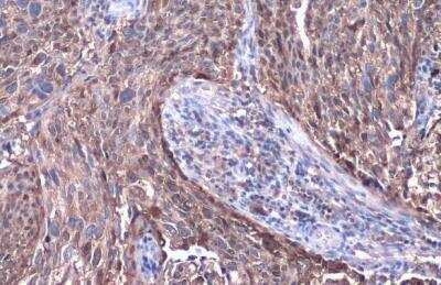 Immunohistochemistry-Paraffin: Serpin B3/SCCA1 Antibody [NBP2-20310]