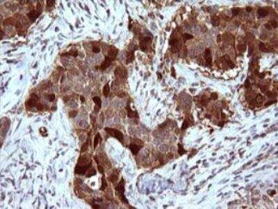 Immunohistochemistry-Paraffin: Serpin B3/SCCA1 Antibody (OTI1A12) - Azide and BSA Free [NBP2-74109]