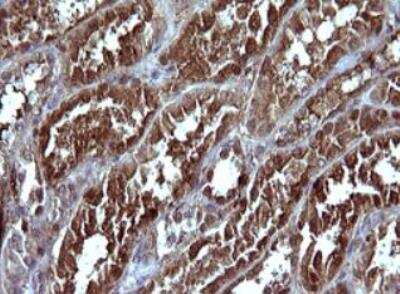 Immunohistochemistry-Paraffin: Serpin B3/SCCA1 Antibody (OTI1A12) - Azide and BSA Free [NBP2-74109]