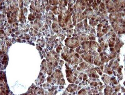 Immunohistochemistry-Paraffin: Serpin B3/SCCA1 Antibody (OTI1A12) - Azide and BSA Free [NBP2-74109]