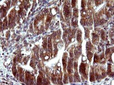 Immunohistochemistry-Paraffin: Serpin B3/SCCA1 Antibody (OTI1A12) - Azide and BSA Free [NBP2-74109]