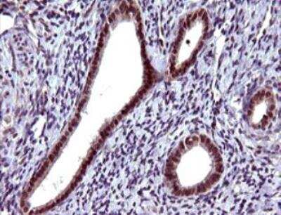 Immunohistochemistry-Paraffin: Serpin B3/SCCA1 Antibody (OTI1A12) - Azide and BSA Free [NBP2-74109]