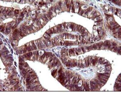 Immunohistochemistry-Paraffin: Serpin B3/SCCA1 Antibody (OTI1A12) - Azide and BSA Free [NBP2-74109]