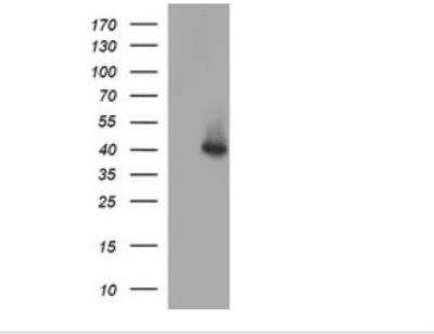 Western Blot: Serpin B3/SCCA1 Antibody (OTI1A12)Azide and BSA Free [NBP2-74109]