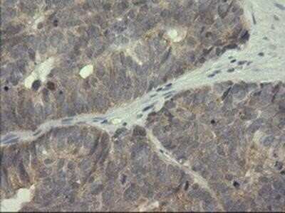 Immunohistochemistry: Serpin B3/SCCA1 Antibody (OTI3C2) - Azide and BSA Free [NBP2-74108]