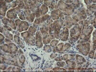 Immunohistochemistry: Serpin B3/SCCA1 Antibody (OTI3C2) - Azide and BSA Free [NBP2-74108]