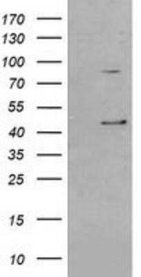 Western Blot: Serpin B3/SCCA1 Antibody (OTI3C2)Azide and BSA Free [NBP2-74108]