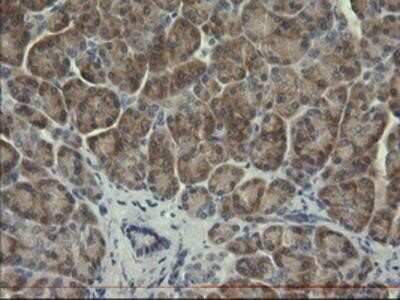 Immunohistochemistry-Paraffin: Serpin B3/SCCA1 Antibody (OTI3C2) [NBP2-03483]
