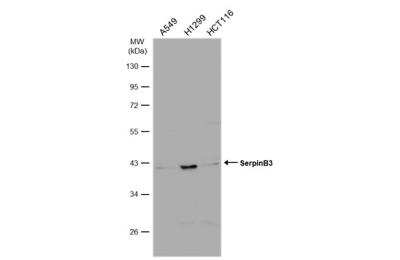Western Blot: Serpin B3/SCCA1 Antibody [NBP2-20310]