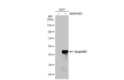 Western Blot: Serpin B3/SCCA1 Antibody [NBP2-20310]