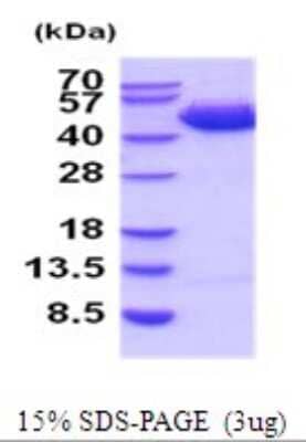 SDS-PAGE: Recombinant Human Serpin B3/SCCA1 His Protein [NBP2-52095]